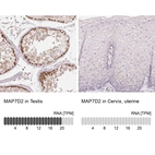 Anti-MAP7D2 Antibody