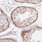 Immunohistochemical staining of human testis shows high expression.