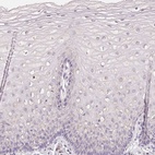 Immunohistochemical staining of human cervix, uterine shows low expression as expected.