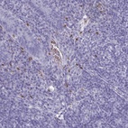 Anti-SERPINB10 Antibody