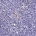 Anti-SERPINB10 Antibody