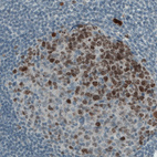 Anti-MKI67 Antibody