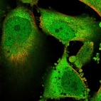 Immunofluorescent staining of human cell line U-251 MG shows localization to nucleoplasm, plasma membrane & cytosol.