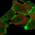 Immunofluorescent staining of human cell line U-251 MG shows localization to nuclear speckles, plasma membrane & cell junctions.
