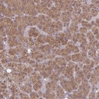 Anti-TBC1D4 Antibody
