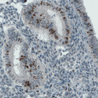 Anti-MKI67 Antibody