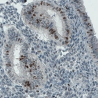 Immunohistochemical staining of human uterus shows nuclear immunoreactivity in a subset of glandular cells.