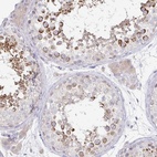 Anti-SPPL3 Antibody