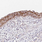 Anti-PRIMA1 Antibody
