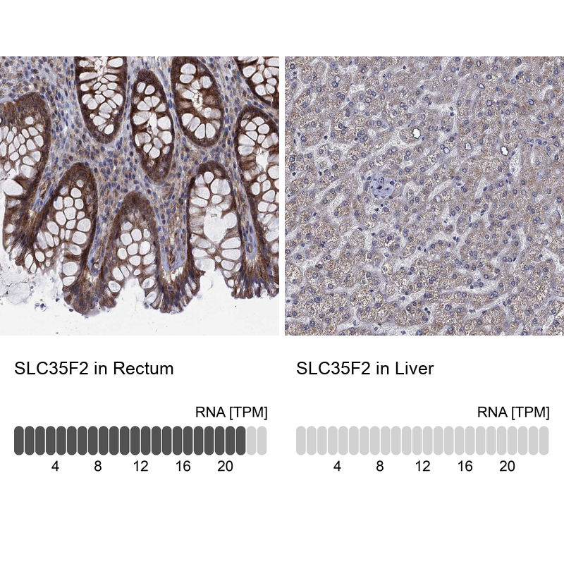 Anti-SLC35F2 Antibody