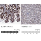 Anti-SLC35F2 Antibody