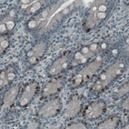 Immunohistochemical staining of human small intestine shows nuclear positivity in a subset of glandular cells.