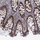 Immunohistochemical staining of human rectum shows high expression.