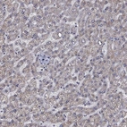 Immunohistochemical staining of human liver shows low expression as expected.