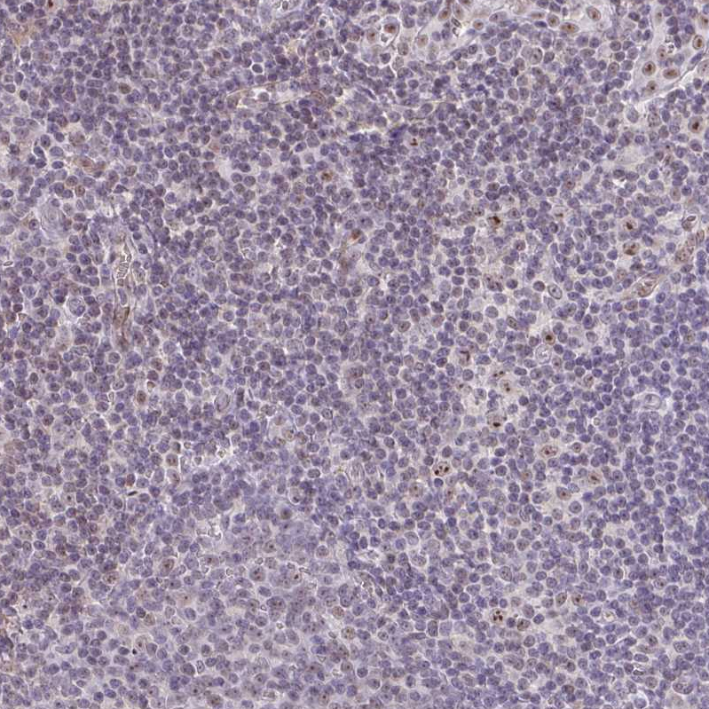 Anti-SENP3 Antibody