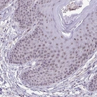 Immunohistochemical staining of human skin shows moderate positivity in nucleoli in squamous epithelial cells.