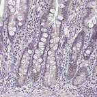 Immunohistochemical staining of human duodenum shows moderate positivity in nucleoli in glandular cells.