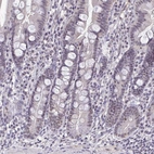 Immunohistochemical staining of human duodenum shows moderate positivity in nucleoli in glandular cells.