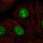 Immunofluorescent staining of human cell line MCF7 shows localization to nucleus & nucleoli.