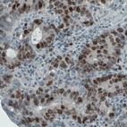 Anti-MKI67 Antibody