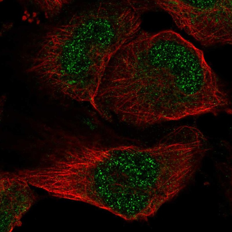 Anti-SLC33A1 Antibody