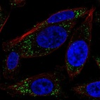 Anti-RRAS Antibody