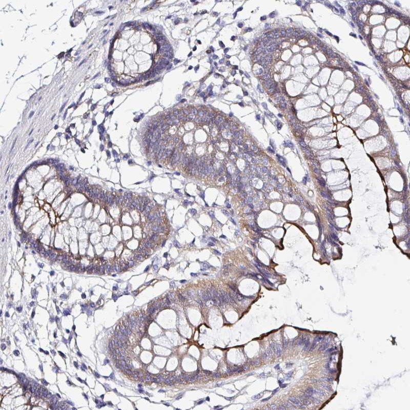 Anti-ARL4D Antibody
