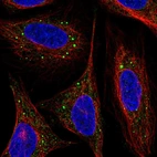 Immunofluorescent staining of human cell line SiHa shows localization to vesicles.