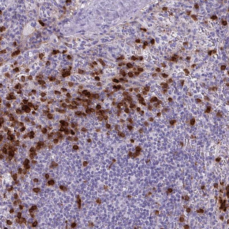 Anti-TMEM133 Antibody