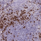Anti-TMEM133 Antibody