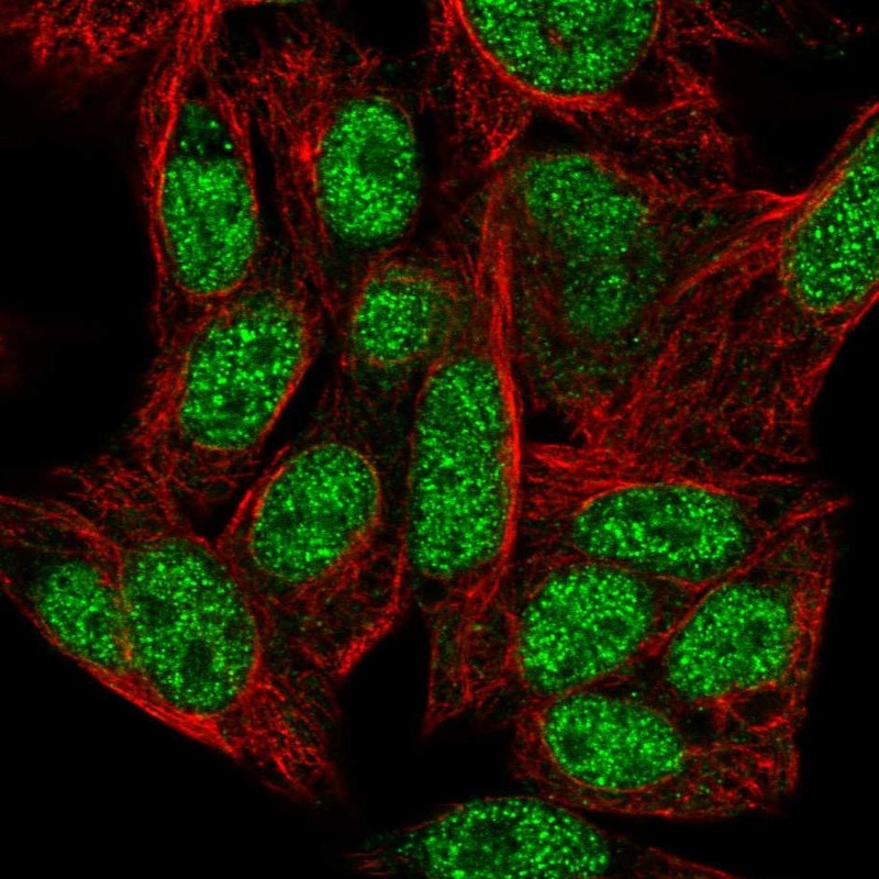 Anti-ZNF556 Antibody