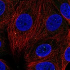 Anti-CCNF Antibody