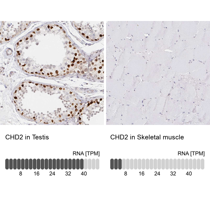 Anti-CHD2 Antibody