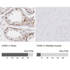 Anti-CHD2 Antibody