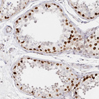 Immunohistochemical staining of human Testis shows strong nuclear positivity in spermatogonia.