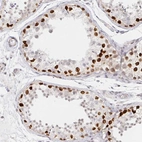 Immunohistochemical staining of human Testis shows strong nuclear positivity in spermatogonia.