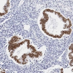 Immunohistochemical staining of human Endometrium shows strong nuclear positivity in glandular cells.