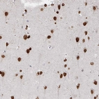 Immunohistochemical staining of human Cerebral cortex shows strong nuclear positivity in neurons and glial cells.