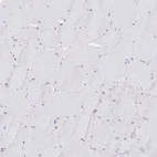 Immunohistochemical staining of human Skeletal muscle shows very weak nuclear positivity in myocytes.
