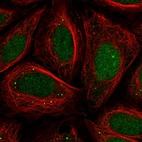 Immunofluorescent staining of human cell line SiHa shows localization to nucleus & vesicles.