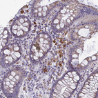 Immunohistochemical staining of human colon shows strong cytoplasmic positivity in leukocytes.