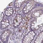 Immunohistochemical staining of human colon shows strong cytoplasmic positivity in leukocytes.