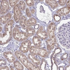 Immunohistochemical staining of human kidney shows moderate cytoplasmic positivity in cells in tubules.