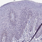 Immunohistochemical staining of human skin shows no positivity in squamous epithelial cells as expected.