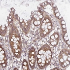 Anti-PDAP1 Antibody