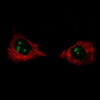 Immunofluorescence staining of A-431 cells using the Anti-MK167 monoclonal antibody, showing specific staining in the nucleoli in green. Microtubule- and nuclear probes are visualized in red and blue, respectively (where available).