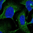 Immunofluorescent staining of human cell line U-2 OS shows localization to the Golgi apparatus & vesicles.