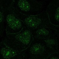 Anti-OR1N2 Antibody