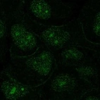 Anti-OR1N2 Antibody