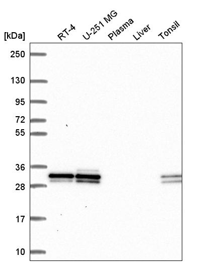 Anti-UBE2R2 Antibody